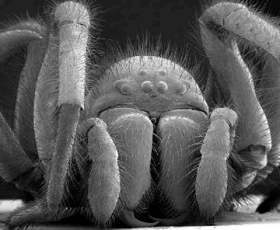 spider under an electron microscope